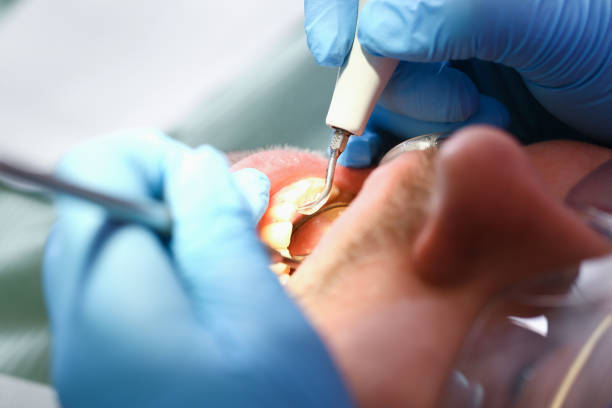 Best Emergency Dental Services for Seniors in Williamsburg, FL