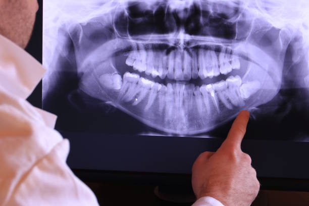 Best Urgent Dental Care for Toothache in Williamsburg, FL